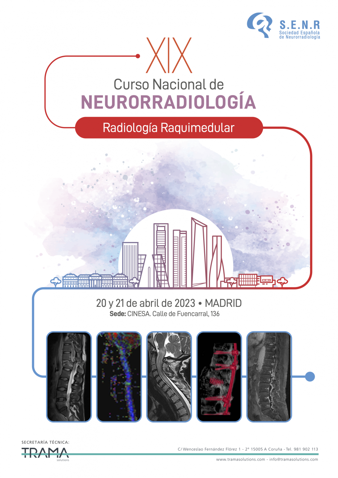 XIX Curso Nacional de Neurorradiología SENR Bienvenid al portal de