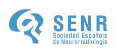 SENR: Bienvenid@ al portal de la SENR (Sociedad Española de Neurorradiología)