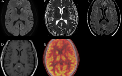 Caso del mes Noviembre 2025