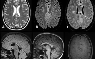 Caso del mes Diciembre 2025