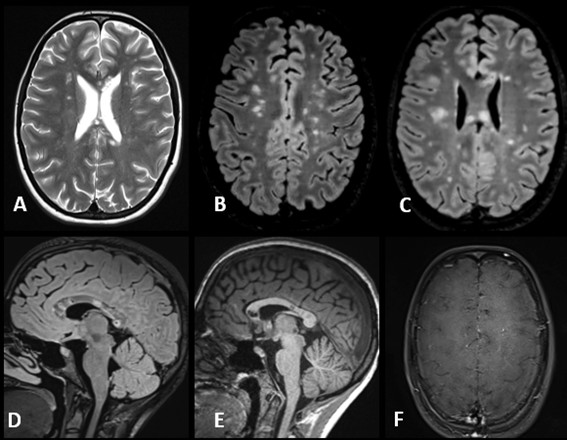Caso del mes Diciembre 2025