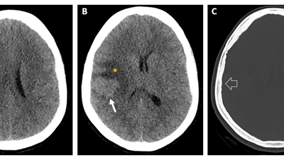 Caso del mes Enero 2026