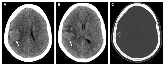 Caso del mes Enero 2026