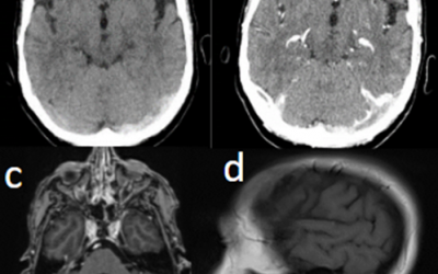 Caso del mes Abril 2026