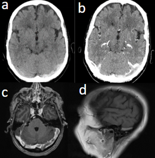 Caso del mes Abril 2026